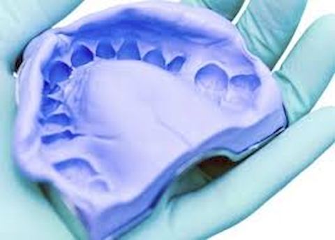 3D сканирование гипсовых стоматологических слепков