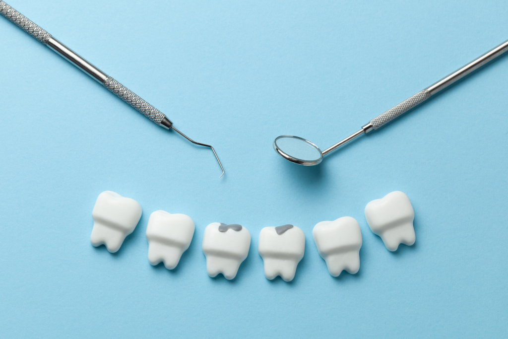 Кариес зубов: причины, стадии развития и факторы риска